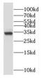 OTU Deubiquitinase 6A antibody, FNab06041, FineTest, Western Blot image 