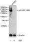 EGFR antibody, A00023Y998, Boster Biological Technology, Western Blot image 
