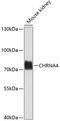 Cholinergic Receptor Nicotinic Alpha 4 Subunit antibody, GTX65576, GeneTex, Western Blot image 