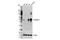 SH3 Domain Containing GRB2 Like 2, Endophilin A1 antibody, 65169S, Cell Signaling Technology, Western Blot image 