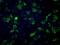 Fumarate Hydratase antibody, MA5-24990, Invitrogen Antibodies, Immunocytochemistry image 