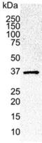 Cyclin Dependent Kinase 6 antibody, NB100-65577, Novus Biologicals, Western Blot image 
