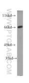 Neurofilament Light antibody, 60189-1-Ig, Proteintech Group, Western Blot image 