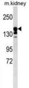 ATP Binding Cassette Subfamily C Member 9 antibody, abx030224, Abbexa, Western Blot image 