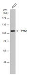 Protein Tyrosine Kinase 2 Beta antibody, GTX633918, GeneTex, Western Blot image 