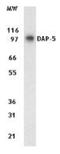 Eukaryotic Translation Initiation Factor 4 Gamma 2 antibody, NB120-11929, Novus Biologicals, Western Blot image 