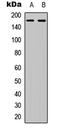 Collagen alpha-6(IV) chain antibody, LS-C358949, Lifespan Biosciences, Western Blot image 