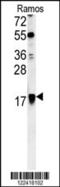 ADP Ribosylation Factor 1 antibody, 62-081, ProSci, Western Blot image 