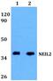 Nei Like DNA Glycosylase 2 antibody, PA5-75742, Invitrogen Antibodies, Western Blot image 