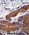 Whirlin antibody, abx026092, Abbexa, Immunohistochemistry paraffin image 