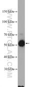 Microspherule Protein 1 antibody, 11362-1-AP, Proteintech Group, Western Blot image 