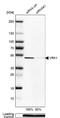 VRK Serine/Threonine Kinase 1 antibody, NBP1-89548, Novus Biologicals, Western Blot image 