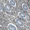 Collagen Type III Alpha 1 Chain antibody, NBP1-84007, Novus Biologicals, Immunohistochemistry paraffin image 