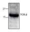 T Cell Receptor Beta Constant 1 antibody, NBP1-50786, Novus Biologicals, Western Blot image 