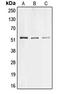 Collagen Type XXVI Alpha 1 Chain antibody, LS-C353861, Lifespan Biosciences, Western Blot image 