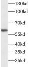 Histone Deacetylase 2 antibody, FNab09976, FineTest, Western Blot image 