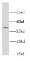 26S proteasome non-ATPase regulatory subunit 7 antibody, FNab06893, FineTest, Western Blot image 