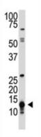 Small Ubiquitin Like Modifier 1 antibody, abx025021, Abbexa, Western Blot image 