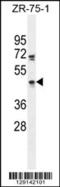 Zinc Finger Protein 578 antibody, 55-774, ProSci, Western Blot image 