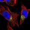Trans-Golgi Network Vesicle Protein 23 Homolog B antibody, NBP1-88090, Novus Biologicals, Immunofluorescence image 