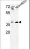 Methionine Adenosyltransferase 2B antibody, LS-C164048, Lifespan Biosciences, Western Blot image 