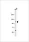 Mitogen-Activated Protein Kinase Kinase Kinase Kinase 1 antibody, 63-315, ProSci, Western Blot image 