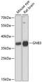 G Protein Subunit Beta 3 antibody, GTX65528, GeneTex, Western Blot image 