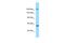 Erythrocyte Membrane Protein Band 4.1 Like 4B antibody, A10481, Boster Biological Technology, Western Blot image 