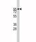 ADAM Metallopeptidase Domain 17 antibody, F44300-0.4ML, NSJ Bioreagents, Western Blot image 