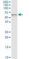 Ferroportin-1 antibody, H00030061-D01P, Novus Biologicals, Western Blot image 