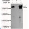 Chromodomain Helicase DNA Binding Protein 4 antibody, LS-C812919, Lifespan Biosciences, Immunoprecipitation image 