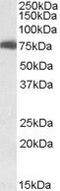 USH1 Protein Network Component Harmonin antibody, PA5-18253, Invitrogen Antibodies, Western Blot image 