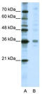 Mediator Complex Subunit 27 antibody, TA343451, Origene, Western Blot image 