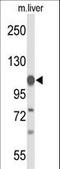 Glycine Decarboxylase antibody, LS-C166500, Lifespan Biosciences, Western Blot image 