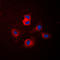 Cytochrome P450 Family 17 Subfamily A Member 1 antibody, LS-C352100, Lifespan Biosciences, Immunofluorescence image 