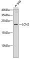 Lipocalin 2 antibody, 13-925, ProSci, Western Blot image 