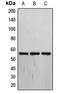 Thyroid Hormone Receptor Alpha antibody, LS-C352943, Lifespan Biosciences, Western Blot image 