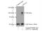 ATPase Na+/K+ Transporting Subunit Alpha 1 antibody, 14418-1-AP, Proteintech Group, Immunoprecipitation image 