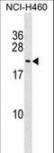 FUN14 Domain Containing 1 antibody, LS-C159685, Lifespan Biosciences, Western Blot image 