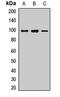 Whirlin antibody, LS-C668972, Lifespan Biosciences, Western Blot image 