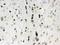 Lumican antibody, PB9662, Boster Biological Technology, Immunohistochemistry frozen image 