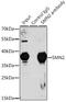 Survival Of Motor Neuron 2, Centromeric antibody, GTX32884, GeneTex, Immunoprecipitation image 