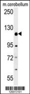 Rap Associating With DIL Domain antibody, 55-102, ProSci, Western Blot image 