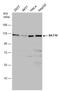 N-Acetyltransferase 10 antibody, GTX119167, GeneTex, Western Blot image 