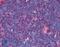 TNF Receptor Superfamily Member 8 antibody, LS-B1865, Lifespan Biosciences, Immunohistochemistry paraffin image 