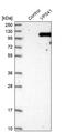 VPS41 Subunit Of HOPS Complex antibody, PA5-54176, Invitrogen Antibodies, Western Blot image 