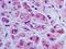 Bone Marrow Stromal Cell Antigen 2 antibody, NBP2-27154, Novus Biologicals, Immunohistochemistry paraffin image 
