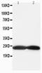 BCL2 Antagonist/Killer 1 antibody, LS-C312600, Lifespan Biosciences, Western Blot image 