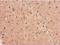 Glycogen Phosphorylase B antibody, NBP1-32799, Novus Biologicals, Immunohistochemistry frozen image 
