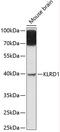 Killer Cell Lectin Like Receptor D1 antibody, A03257, Boster Biological Technology, Western Blot image 